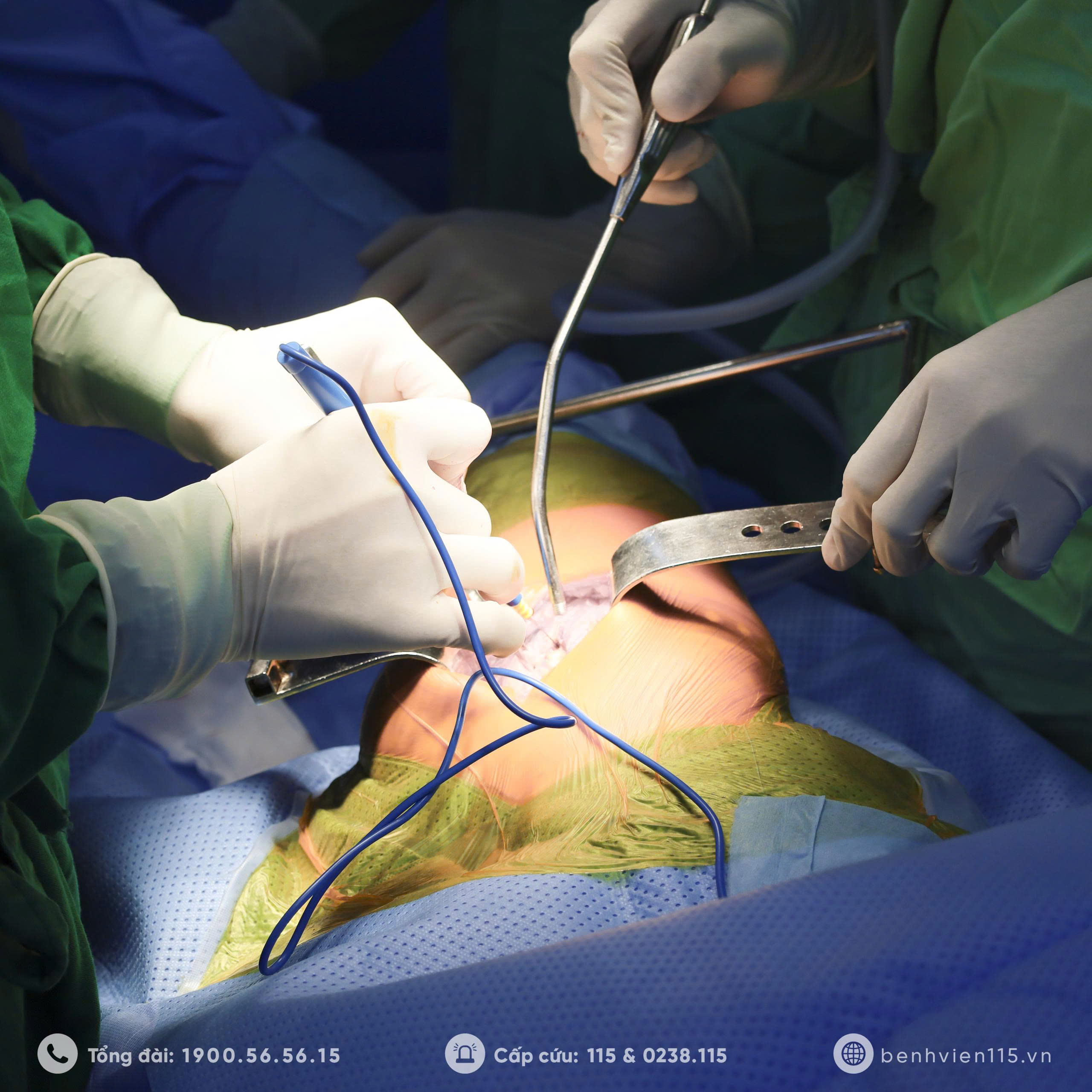 Bác sĩ đang thực hiện phẫu thuật 